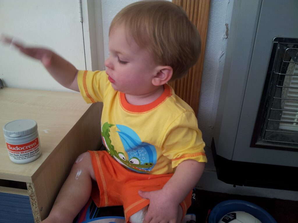 A young child wearing a bright yellow shirt and orange shorts sits indoors with Sudocrem cream on their left leg. They are looking to the left, lifting one hand, with a tub of Sudocrem on a wooden table beside them.